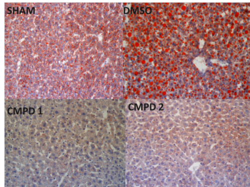 Fatty liver compounds